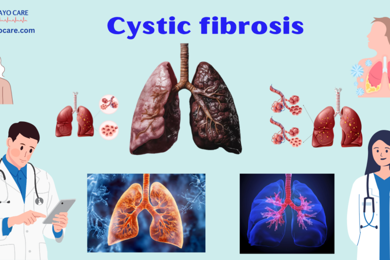 Cystic Fibrosis: Causes, Symptoms, Prevention & Treatment