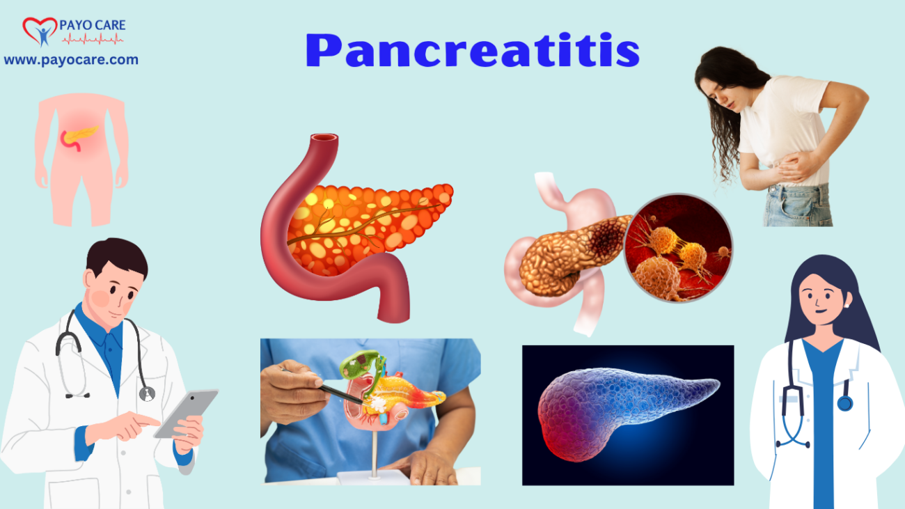 Pancreatitis:Types, Causes, Symptoms, Prevention, Diagnosis & Treatment