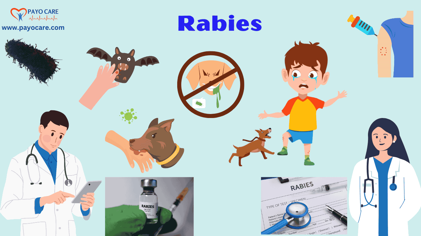 Rabies :Causes, Symptoms & Treatment