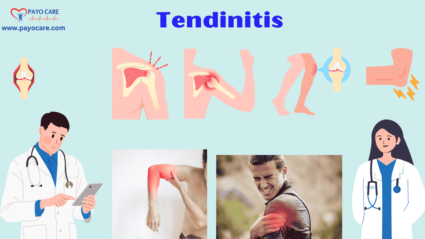 Tendinitis: Causes, Symptoms, Prevention & Treatment