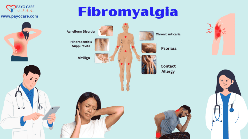 Fibromyalgia :Types, Causes, Symptoms, Prevention, Diagnosis & Treatment