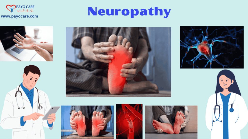 Neuropathy: Types, Causes, Symptoms, Prevention, Diagnosis, and Treatments Neuropathy: Types, Causes, Symptoms, Prevention, Diagnosis, and Treatments