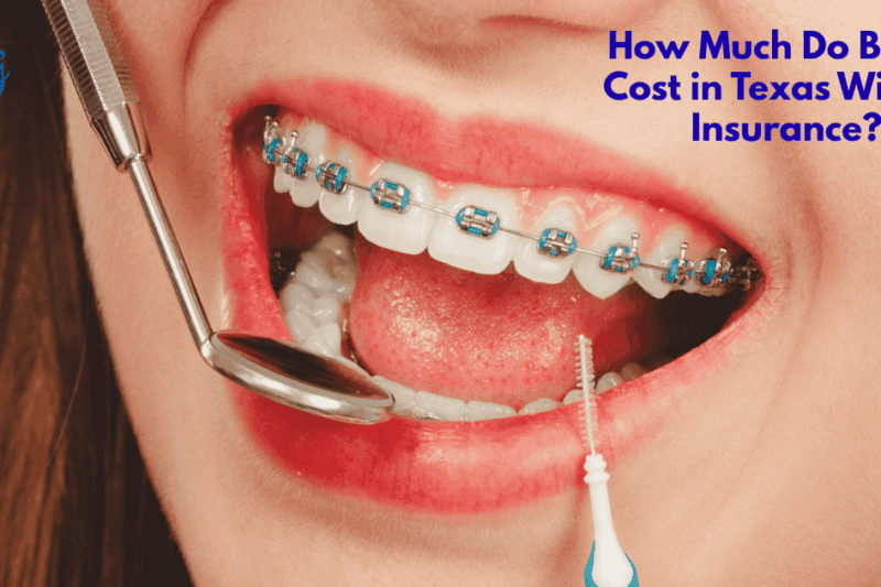 How Much Do Braces Cost in Texas Without Insurance? Real Prices & Tips
